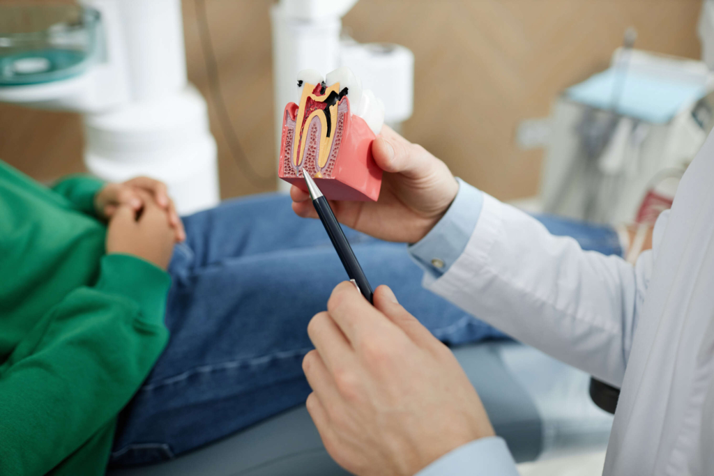 Root Canal Therapy