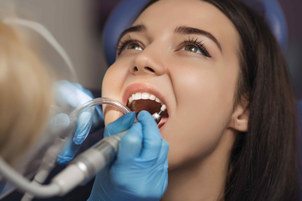 Tooth Filling Services